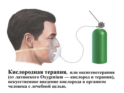 Кислородная терапия