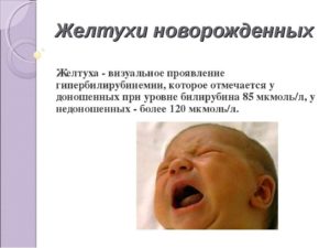 Желтуха