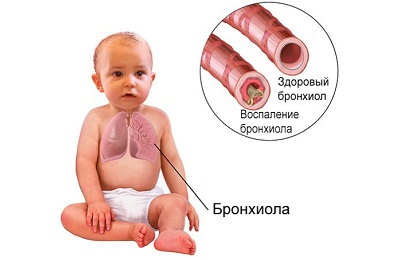 Больной ребенок