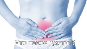 Цистит