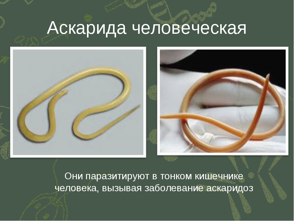 Человеческая аскарида