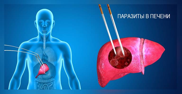Паразиты в печени человека