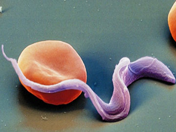 toksoplazmoza