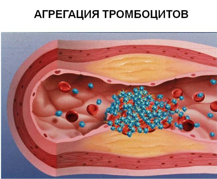 agregaciya