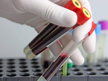 testosteron (24)