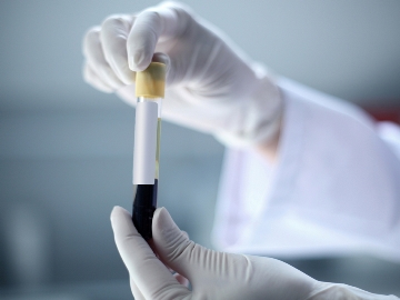 testosteron (26)