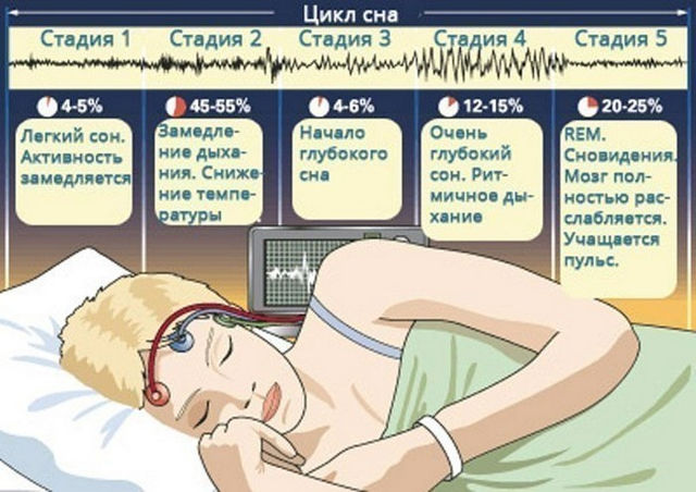 фаза быстрого сна