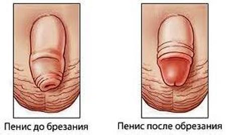 обрезание
