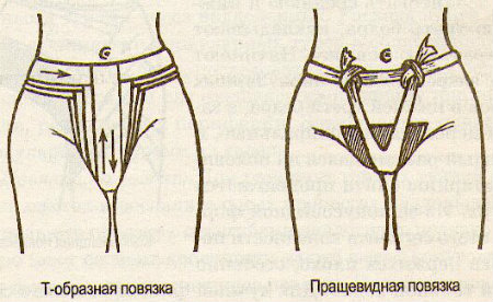 схема
