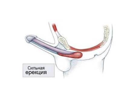 Эрекция у мужчины