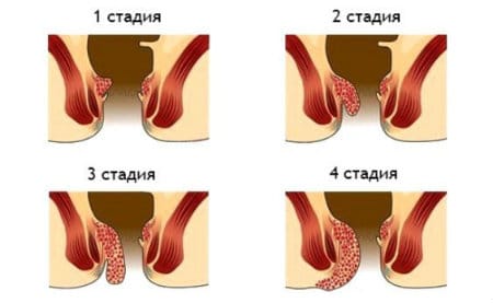 схема