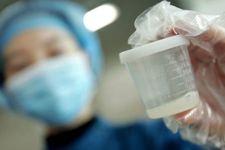 Врач держит сперму в баночке