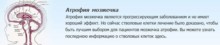 Что такое атрофия мозжечка