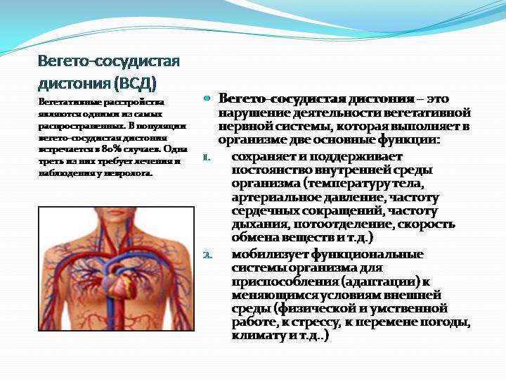 ВСД