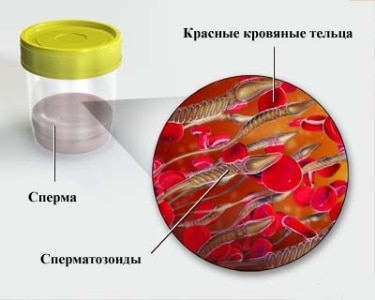 кровь в сперме