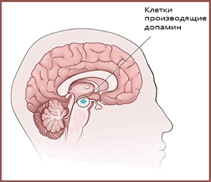 Причины болезни Паркинсона