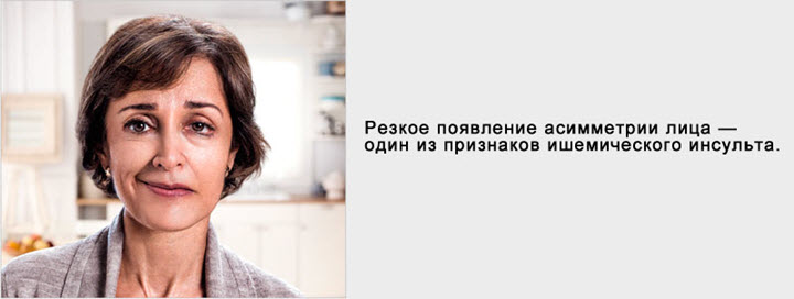 Симптомы инсульта