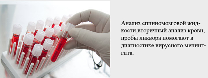 Пункция при менингите