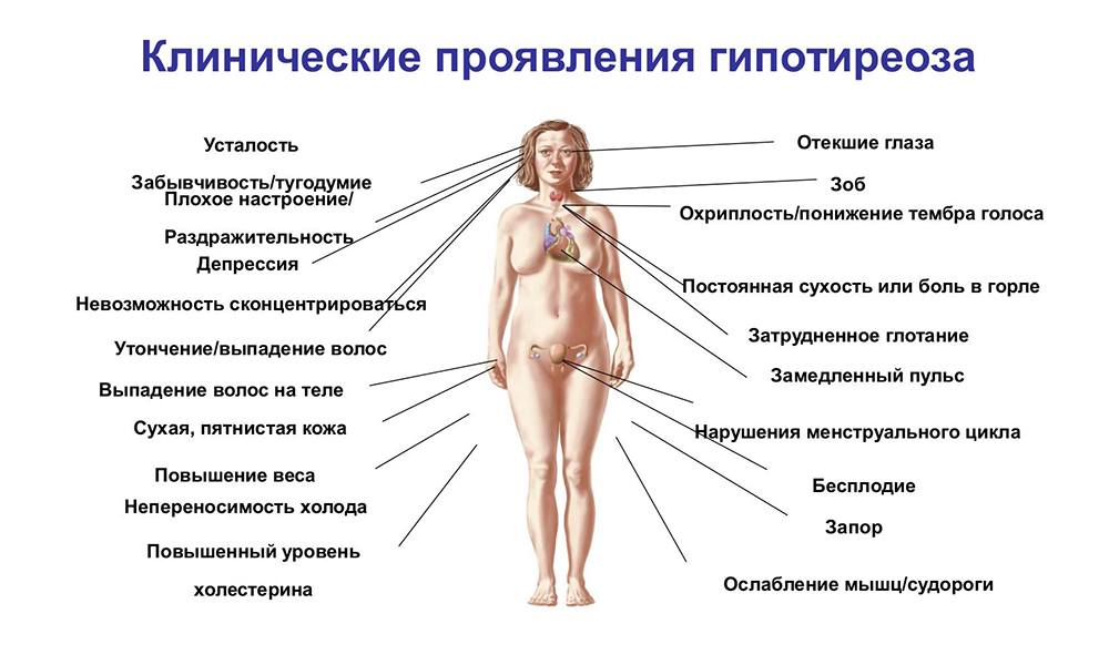 Гипотиреоз. Симптомы и лечение гипотиреоза щитовидной железы.