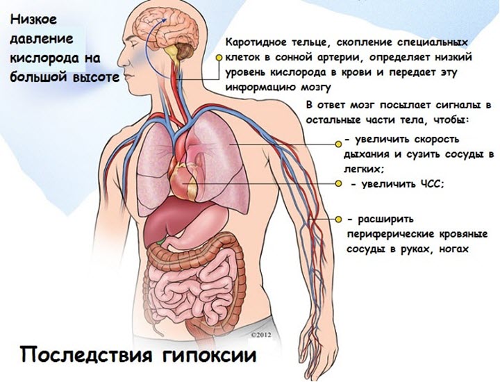Последствия гипоксии