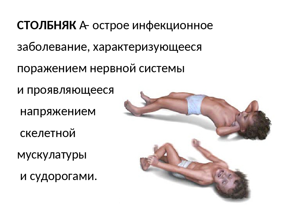 Столбняк - симптомы, признаки и лечение. Профилактика и прививка
