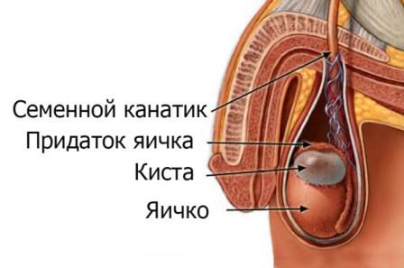 инфограма патологии тестикул