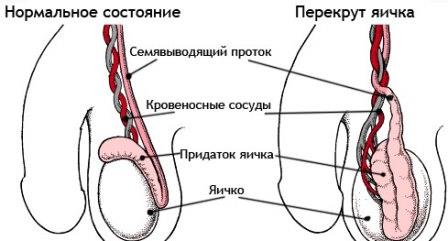 инфограма травмы
