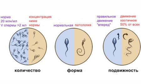 инстаграма нормы сперматозоидов