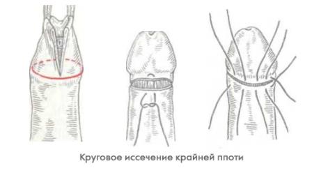 инстаграма обрезания