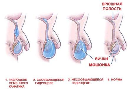 инстаграма заболевания