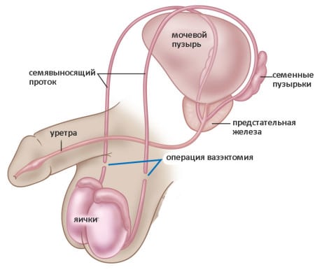 инстраграма мочеполовой системы мужчины