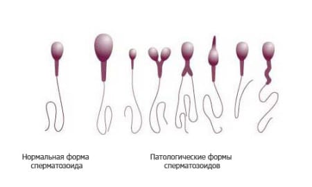 инстраграма мужских половых клеток