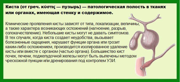 Что такое киста