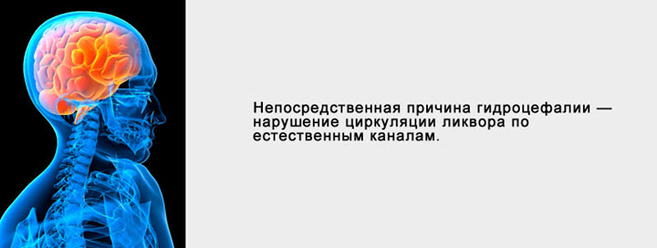 Причина гидроцефалии
