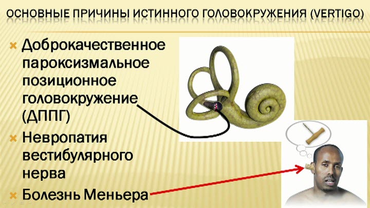 Причины истинного головокружения