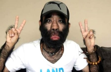 мужчина с гипертрихозом мужчина с гипертрихозом