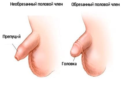 обрезание