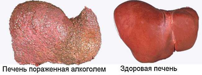 больной и здоровый орган