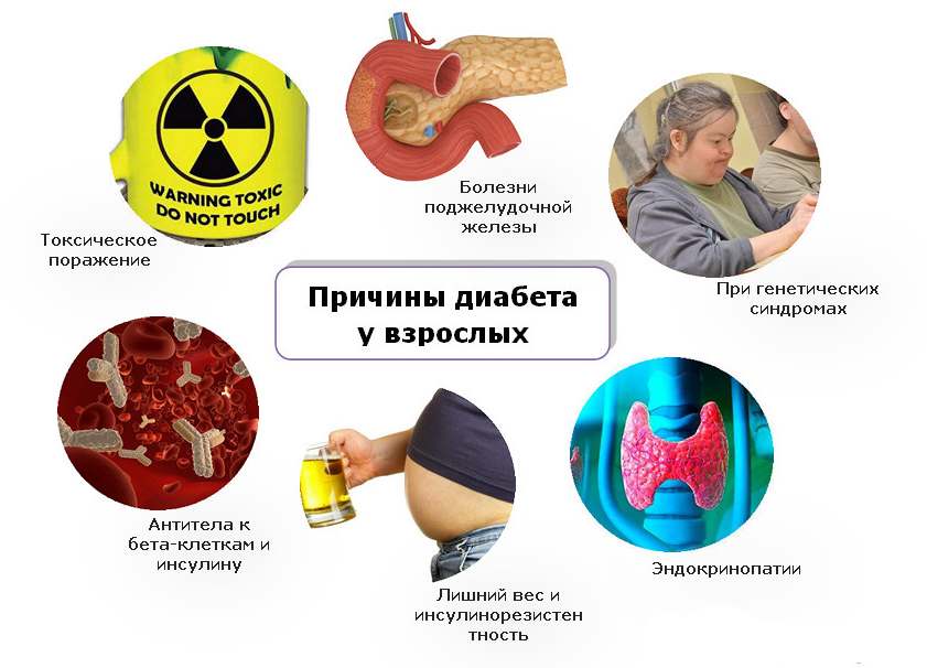 инфографика о причинах диабета у взрослых