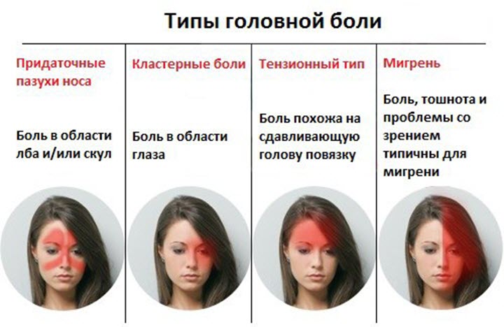 Типы головной боли
