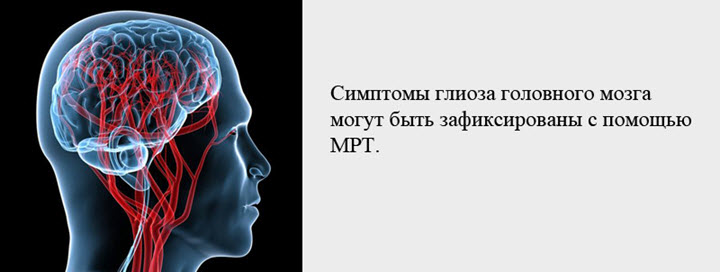 Выявление симптомов глиоза