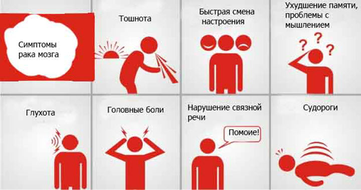 Симптомы мозговой опухоли