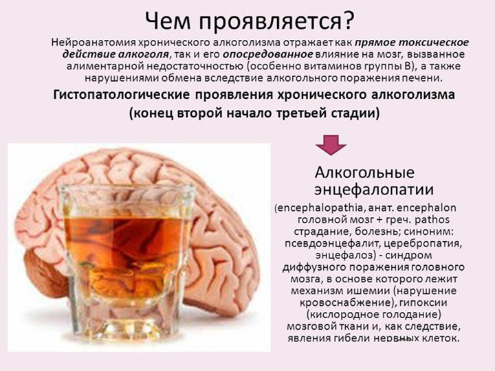 Алкогольные энцефалопатии