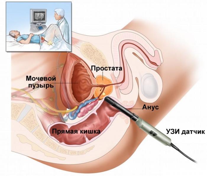 рисунок трузи