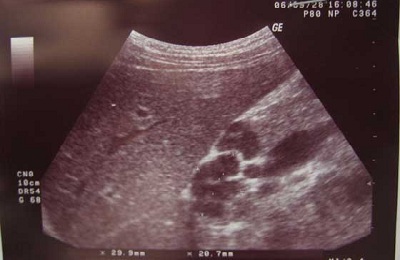 Узи диагностика