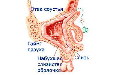 Пазухи носа
