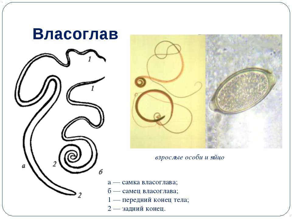 Власоглава