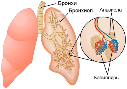 Альвеолит легких