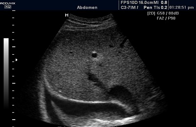 Диагностика болезни