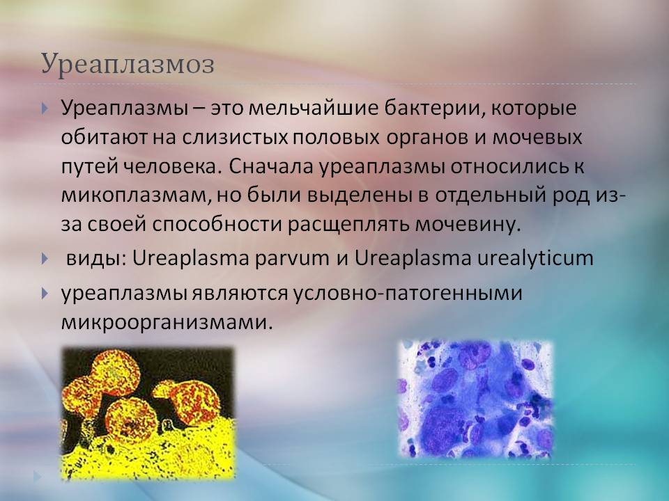 Уреаплазмоз